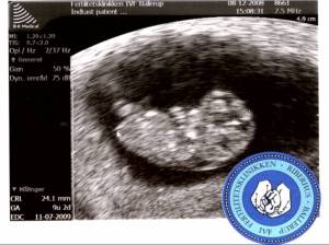 Her er barn'is 24 mm